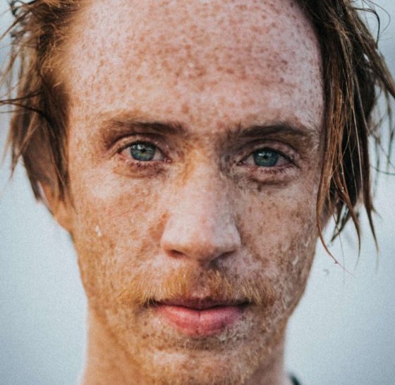 Why are there so many redheads in Ireland? | Ireland Chauffeur Travel Why are there so many redheads in Ireland? | Ireland Chauffeur Travel